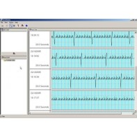 Omron HeartScan Extension Pack